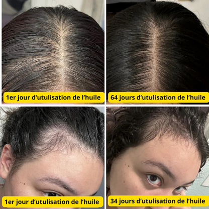 Huile de Croissance Naturelle